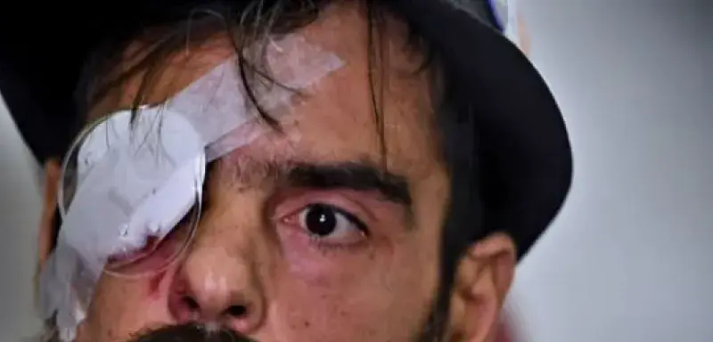 Illustration procès du policier accusé d'avoir éborgné Jérôme Rodrigues lors du mouvement des gilets jaunes