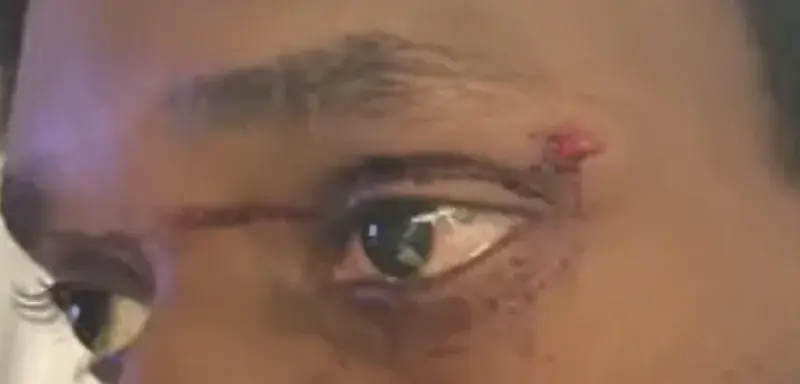 Illustration pour l'article sur l'agression d'Evan par la BAC à Toulouse