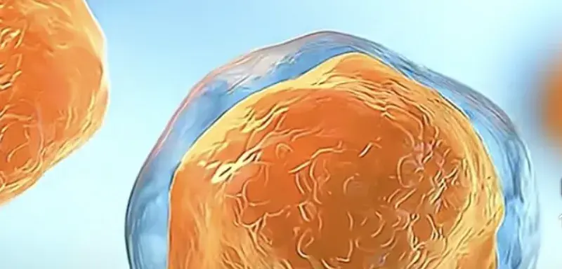 Épidémie de cyclosporose aux États-Unis