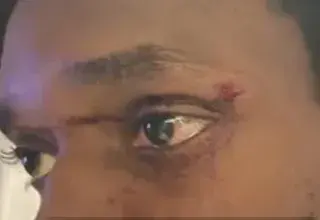 Illustration pour l'article sur l'agression d'Evan par la BAC à Toulouse