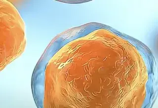 Épidémie de cyclosporose aux États-Unis