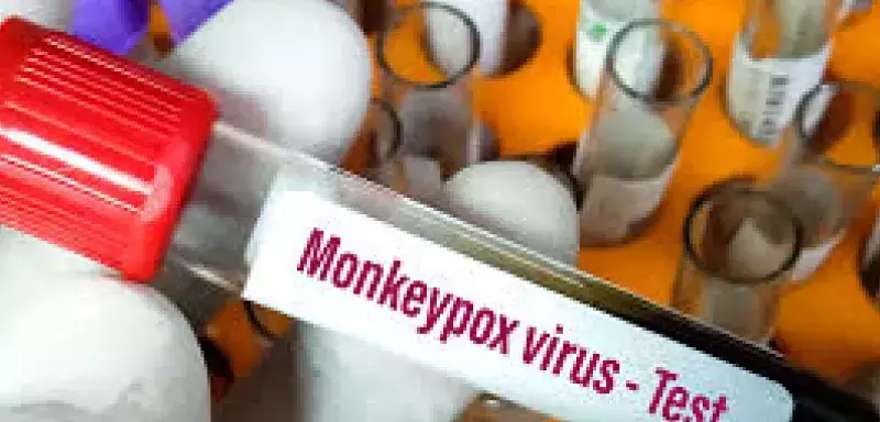 France : un nouveau variant du virus mpox (variole du singe), identifié pour la première fois 