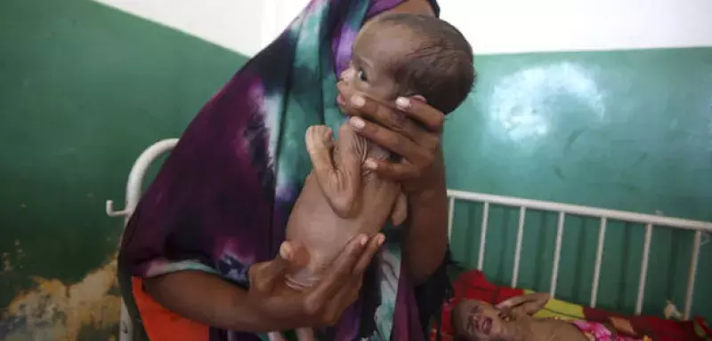  Environ 202.600 enfants de moins de cinq ans souffrent de malnutrition aiguë... (DR)