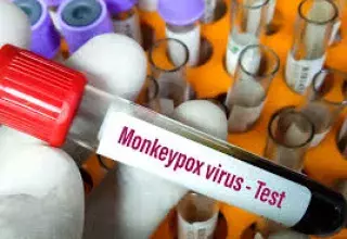 France : un nouveau variant du virus mpox (variole du singe), identifié pour la première fois 